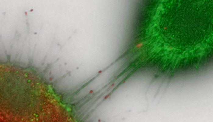 3D reconstruction of CAD cells expressing mCherry-Myo10.